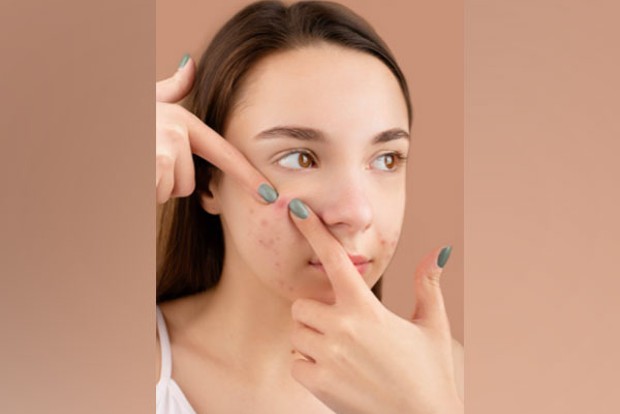 Research finds how fat cells in skin help fight acne