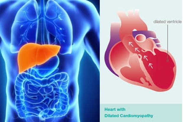 Ask your doctor: Prevention of liver diseases and about Cardiomyopathy