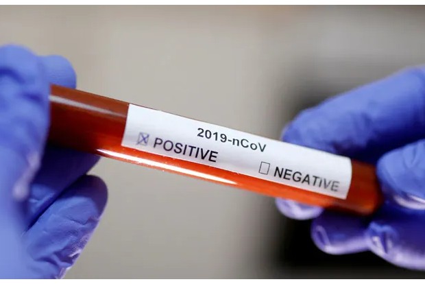 Vellore SP, 10 prisoners at Polur test positive Vellore SP, 10 prisoners at Polur test positive