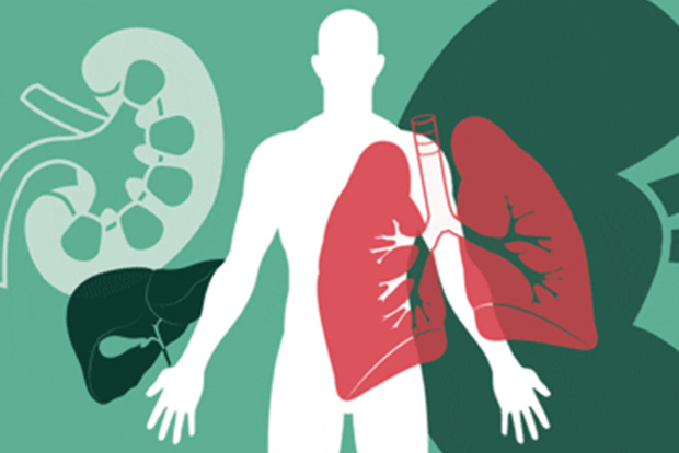 Braindead’s organs save three lives