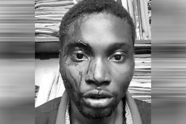 Nigerian student assaulted over car parking dispute