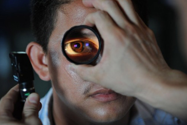 Rubbing the cloud off cataract