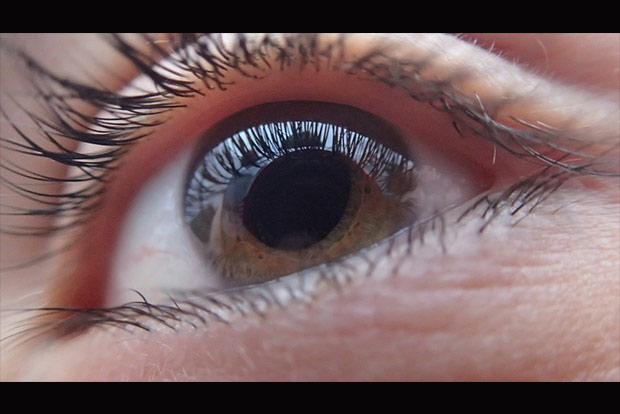 16 eye patients could lose vision: Doctors