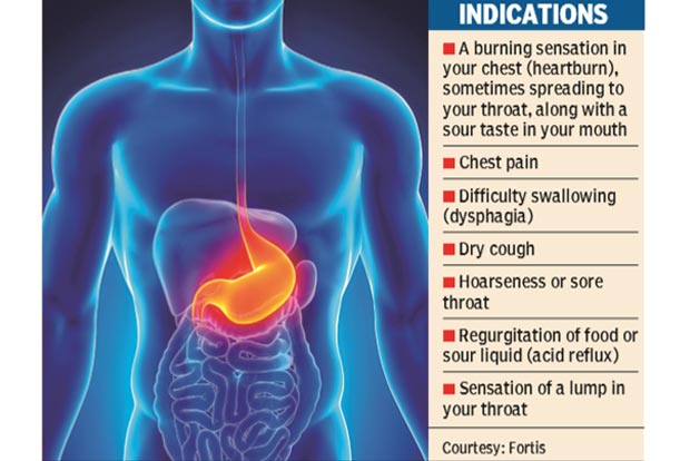 Don’t take it light, heart burns could be a symptom of GERD