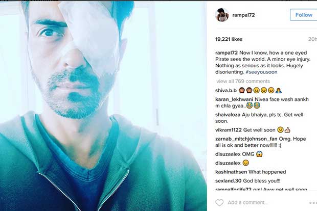Arjun Rampal suffers an eye injury, says it’s nothing serious