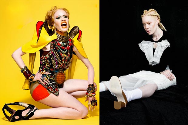 African-American model with albinism redefines beauty