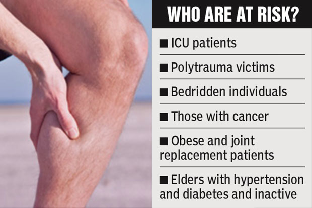 DVT can be deadly if not diagnosed and treated on time: Experts