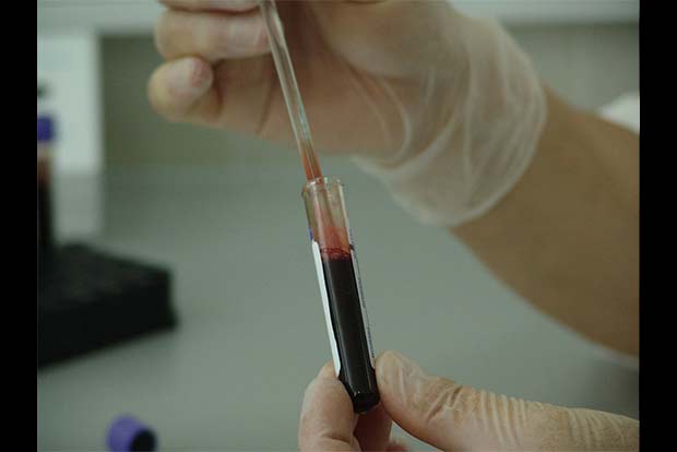 New test identifies TB infection within hours