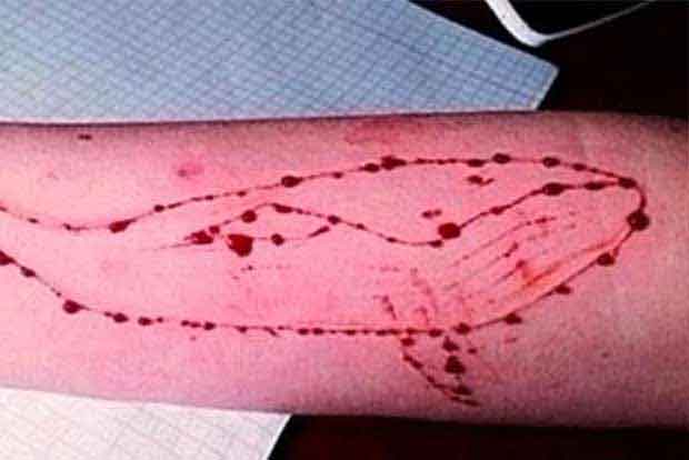 Blue Whale challenge: 16-year old boy tries to end life Blue Whale challenge: 16-year old boy tries to end life